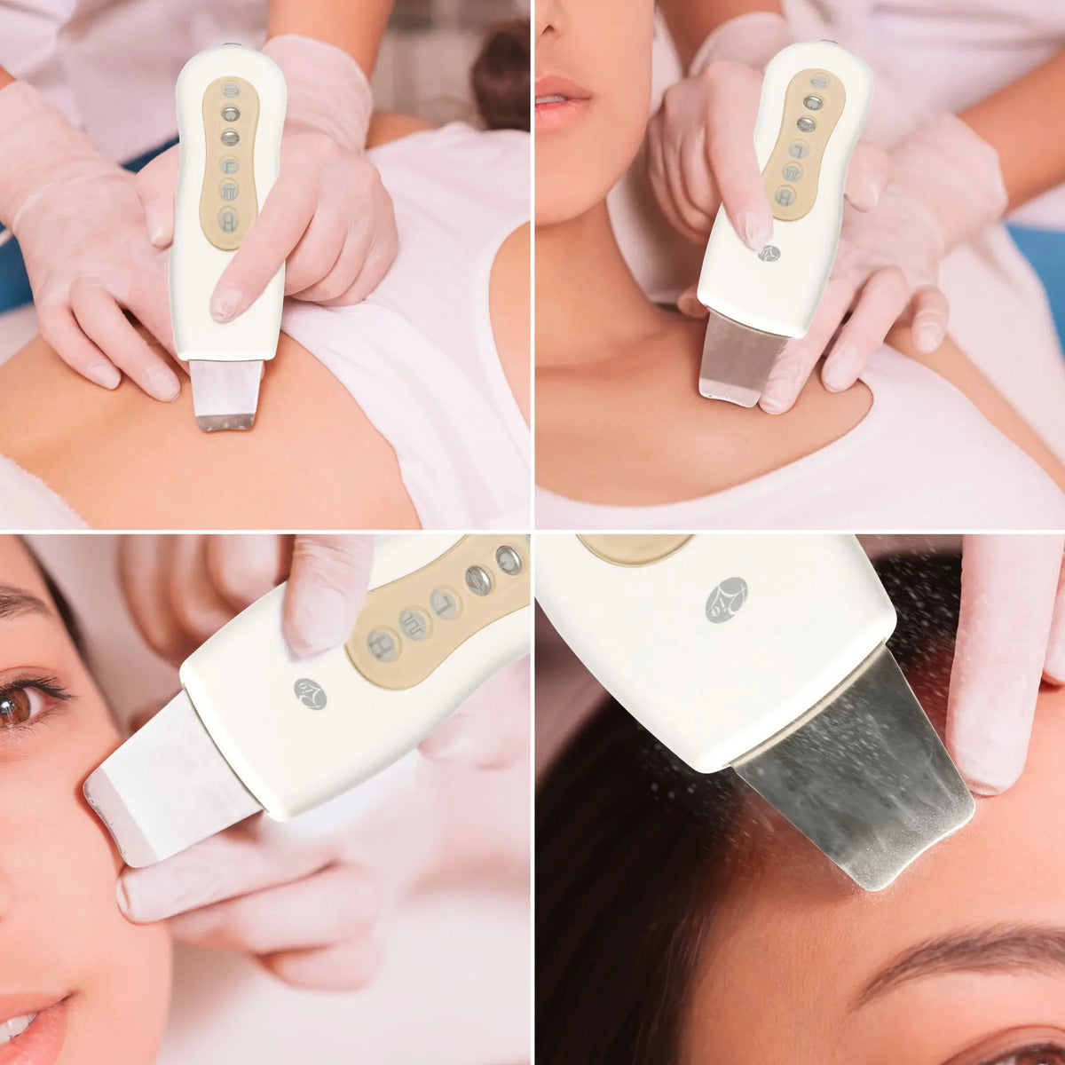 Ultrazvuková špachtľa Rio Beauty FASS3